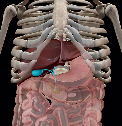 The Petulant Pebbles (Cont.) The Anatomy and Pathology of Gallstones